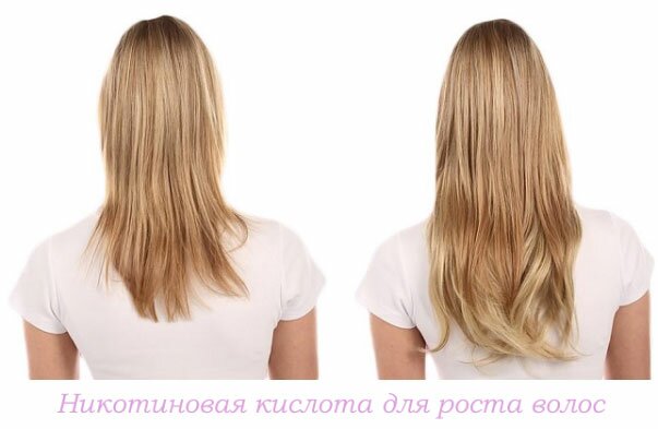 Никотиновая кислота для роста волос, фото до и после